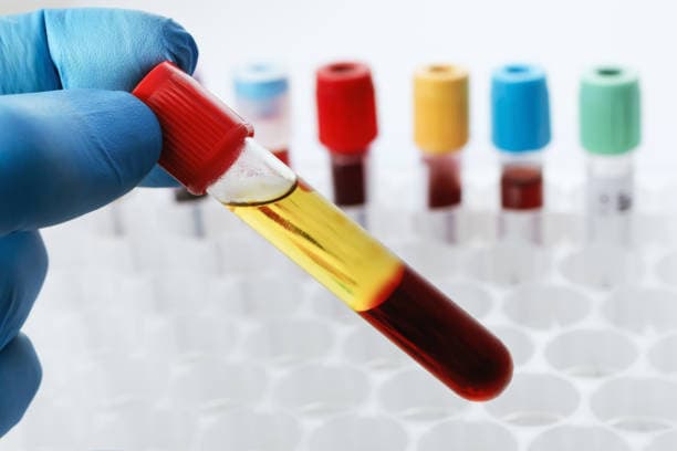 Penile PRP Therapy – A Natural Way to Restore Confidence and Performance
